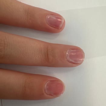 Tırnak Sorunumda İlgisiz Ve Çözüm Sunmayan Yaklaşım