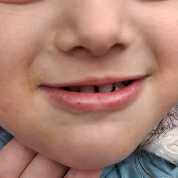 Kreşte Yetersiz Eğitim Ve İlgisiz Yönetim Nedeniyle Hayal Kırıklığı