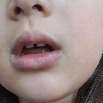 Kreşte Yetersiz Eğitim Ve İlgisiz Yönetim Nedeniyle Hayal Kırıklığı