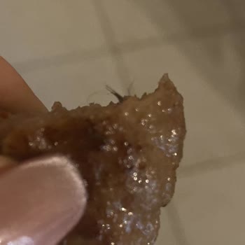 Aldığım Köftede Yabancı Madde Ve İlgisizlik Sorunu