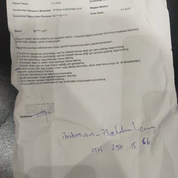 Rayban Gözlükte Çerçeve Soyulması Ve Mağduriyet