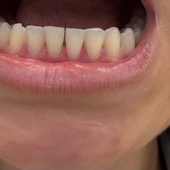 Tedavi Sonrası Memnuniyetsizlik Ve Hasta Hakları İhlali