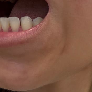 Tedavi Sonrası Memnuniyetsizlik Ve Hasta Hakları İhlali