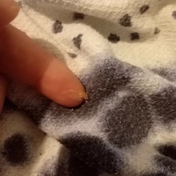 Aldığım Çikolatanın İçinden Yabancı Madde Çıktı, Güvenim Sarsıldı