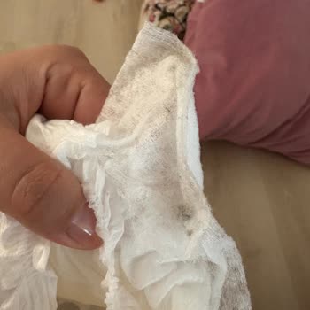 Aldığım Sleepy Bionatural Külot Bezde Steril Olmayan Ve Kirli Görüntü