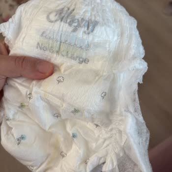 Aldığım Sleepy Bionatural Külot Bezde Steril Olmayan Ve Kirli Görüntü