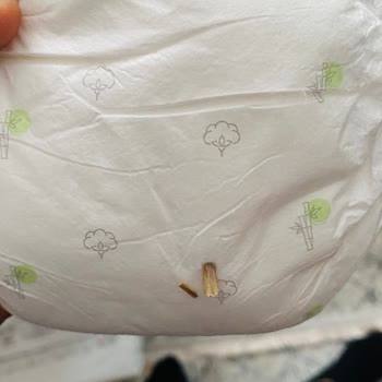Bebek Bezinde Tüylenme Ve Kıymık Tehlikesi Yaşadık