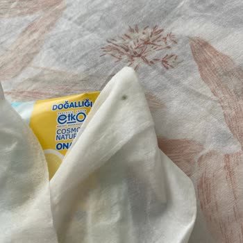 Yenidoğan Islak Mendilde Küf Oluşumu Bebeğim İçin Endişe Verici