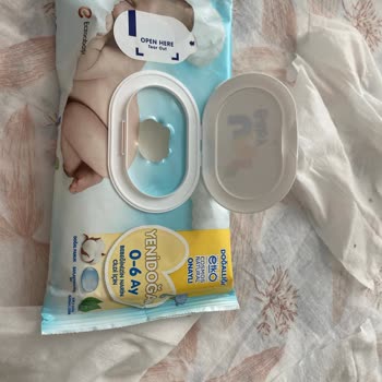 Yenidoğan Islak Mendilde Küf Oluşumu Bebeğim İçin Endişe Verici