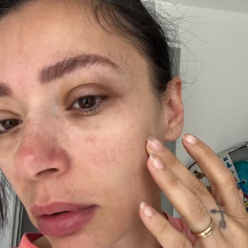 Sephora Alerjik Reaksiyon Ve Yetersiz Müşteri Hizmeti Deneyimi