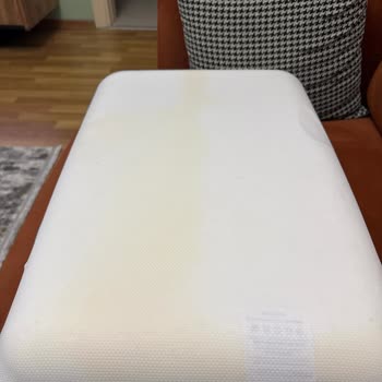 Kılıfın İçinden Çıkan Sarı Lekeler Ve Hatalı Parça Şoku