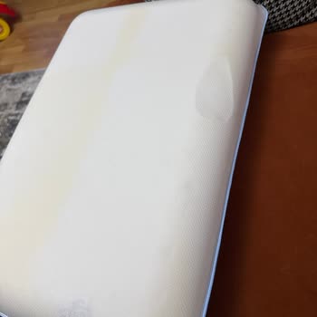 Kılıfın İçinden Çıkan Sarı Lekeler Ve Hatalı Parça Şoku