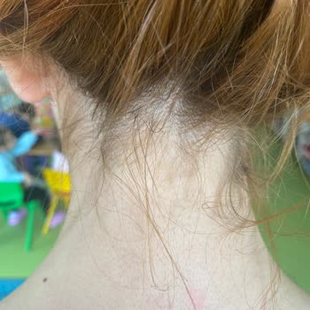 Şerifali Şubesinde Hizmet Kalitesi Ve Hijyen Sorunları