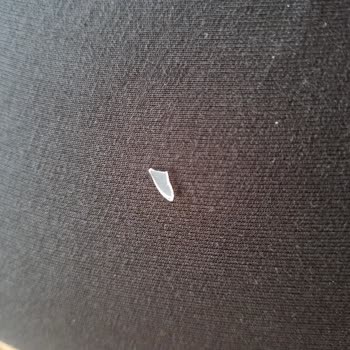 Dondurmadan Çıkan Plastik Parça Sağlığımı Tehdit Etti