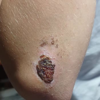 Onvo Scooter RX-5'te Güvenlik Sorunları Ve Yetersiz Servis Deneyimi