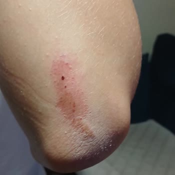 Onvo Scooter RX-5'te Güvenlik Sorunları Ve Yetersiz Servis Deneyimi