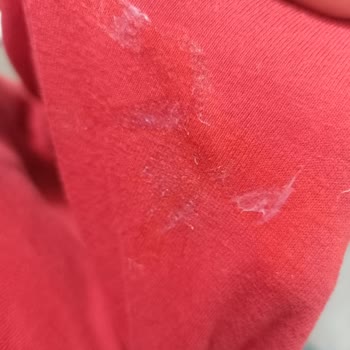 Sensodyne Diş Macunu Ağız İçinde Soyulma Ve Rahatsızlık Yapıyor