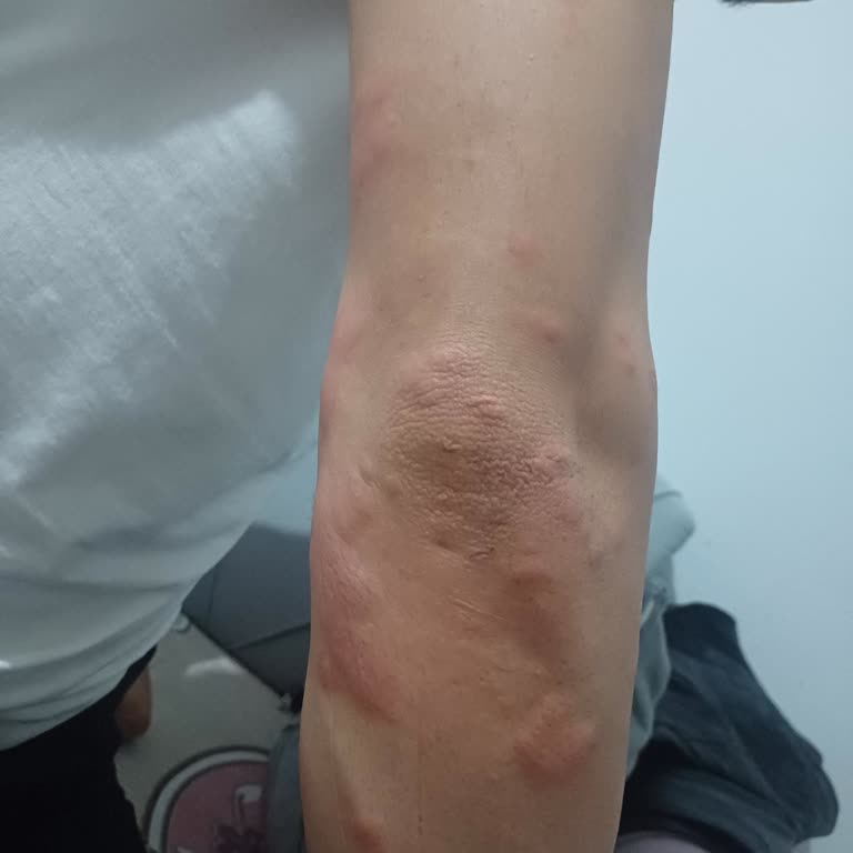 Villa Seyahat'te Arıza Ve Hijyen Sorunlarıyla Hayal Kırıklığı