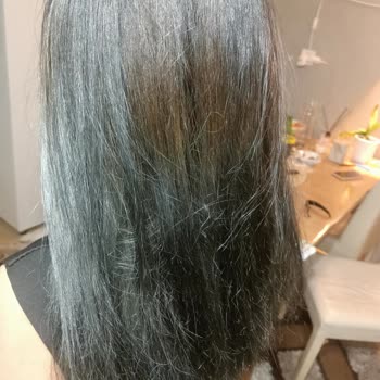 Yanlış Saç Boyası Nedeniyle Yaşanan Mağduriyet