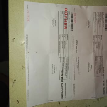 Ray-Ban Gözlüğüm Göz Sağlığımı Tehdit Etti, Değişim Talebim Reddedildi