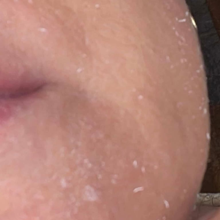 Bioderma Güneş Kreminde Sahte Ve Etkisiz Ürün Şüphesi