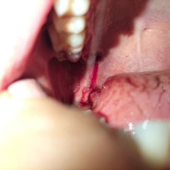 Diş Çekimi Sırasında Yaşanan Ciddi Mağduriyet Ve İhmal
