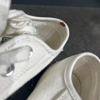 Kısa Sürede Ayakta Yaraya Sebep Olan Ayakkabı İçin Ret Cevabı Ve Mağduriyet