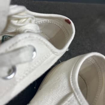 Kısa Sürede Ayakta Yaraya Sebep Olan Ayakkabı İçin Ret Cevabı Ve Mağduriyet