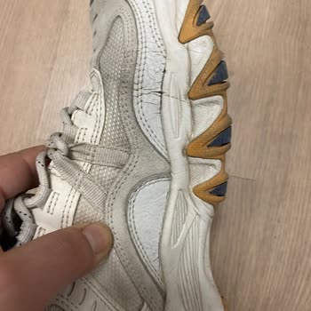 Skechers Ayakkabıda Kısa Sürede Açılma Ve Garanti Hayal Kırıklığı