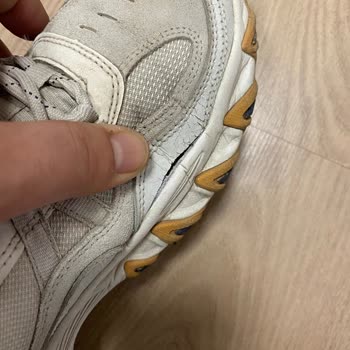 Skechers Ayakkabıda Kısa Sürede Açılma Ve Garanti Hayal Kırıklığı