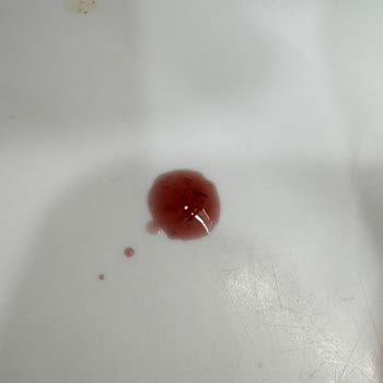 Zühre Ana Karadut Özünde Kalite Sorunu: Tadı Ve Görüntüsü Değişti