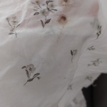 Hediye Gelen Pike Setinde Leke Problemi Ve Değişim Sorunu