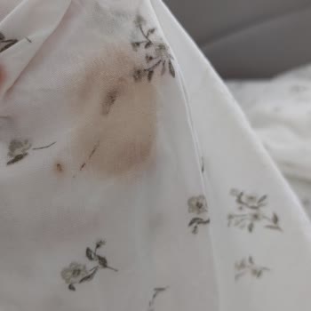 Hediye Gelen Pike Setinde Leke Problemi Ve Değişim Sorunu