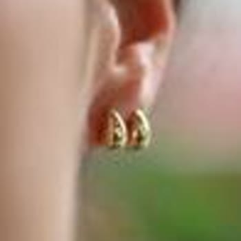 Trendyol Altın Küpe İadesi Haksız Şekilde Reddedildi