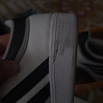 Kısa Sürede Rahatsızlık Veren Ayakkabı Ve Olumsuz İade Deneyimi