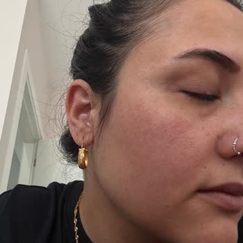 La Roche Posay Ürününden Sonra Yüzümde Yanma Ve Kızarıklık Oluştu