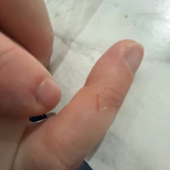 A101den Alınan Tuzlukta Çelik Çapak Nedeniyle El Kesilmesi Ve İlgisizlik