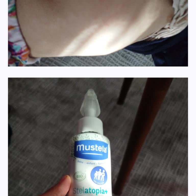 I Used Mustela Lipid-Replenishing Cream and It Caused Allergic Rash on My Child