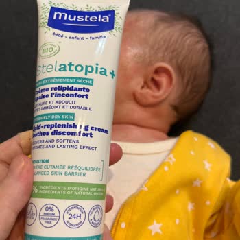Mustela Stelatopia Cream Caused Severe Redness on My 1-Month-Old Baby’s Skin