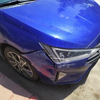 Kasko Ve Eksper İşbirliğiyle Mağduriyet: Far Değişimi Reddi