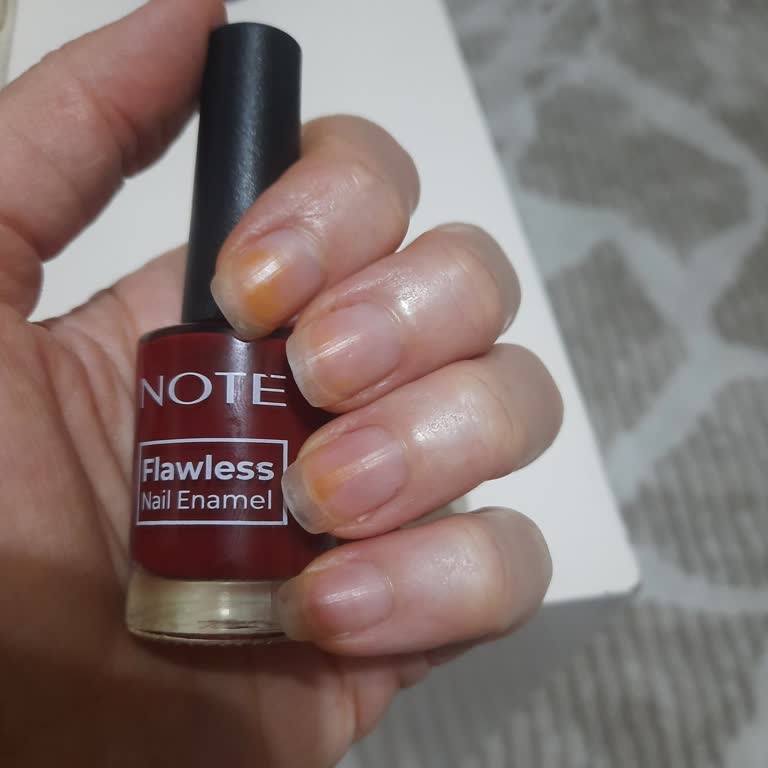 Oje Sonrası Tırnaklarda Sarı Leke Problemi Ve Sağlık Endişesi