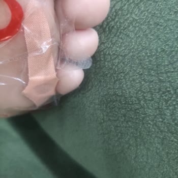 Yeni Model Bant Ürünüyle İlgili Kullanıcı Şikayeti