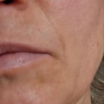 Medica World Estetik Memnun Kalmadım