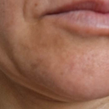 Medica World Estetik Memnun Kalmadım