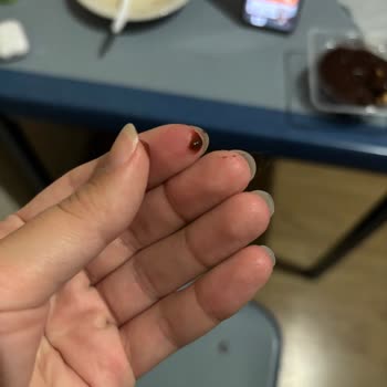 BİM'den Aldığım Profiterolden Saç Çıkması Ve Hijyen Sorunu