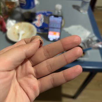 BİM'den Aldığım Profiterolden Saç Çıkması Ve Hijyen Sorunu