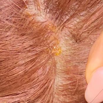 Mehmet Kenç (The Blond Ataşehir) Saçımı Mahvetti