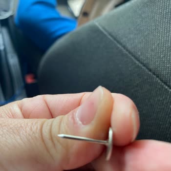 Çocuğumun Ayakkabısında Unutulan Çivi Yüzünden Yaşadığımız Tehlike Ve Mağduriyet