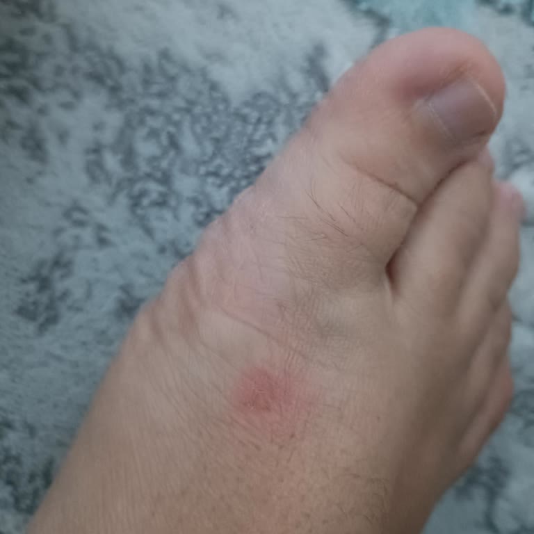 Aldığım Sandaletler Ayağımı Yaraladı, Değişim Veya İade İstiyorum