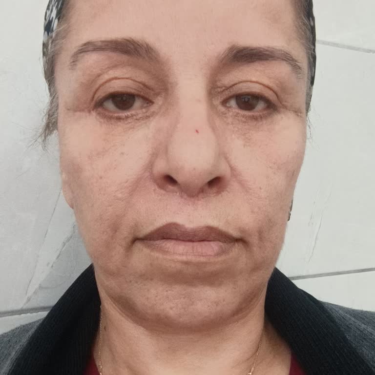 Aldığım Bakım Hizmeti Beklentilerimi Karşılamadı